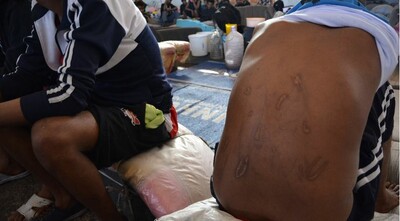 Les migrants sont souvent torturés dans les prisons libyennes. Crédit : Jérôme Tubiana/MSF